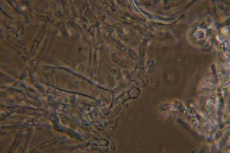 Crostina su Larice da det.-foto 2717(Vesiculomyces citrinus)